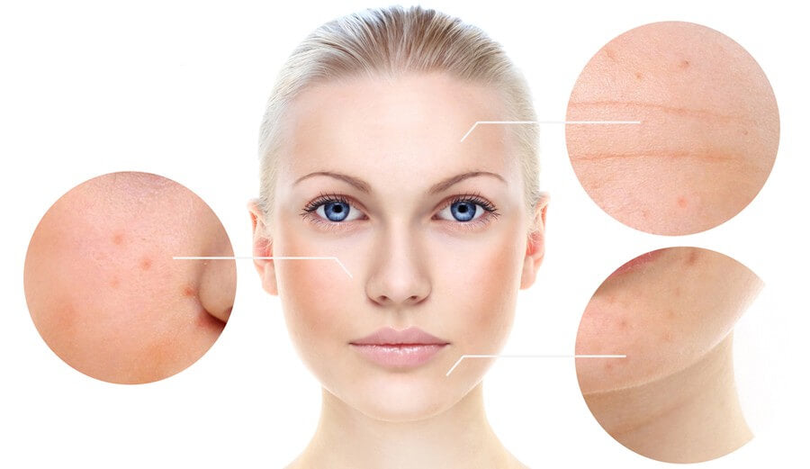 Chemical Peels Demystified: Benefits, Myths, and Smarter Skin Recovery